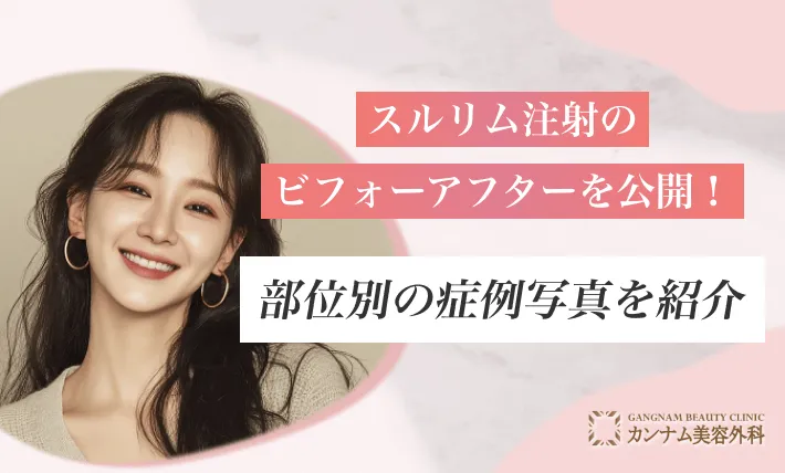 スルリム注射のビフォーアフターを公開！部位別の症例写真を紹介