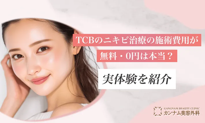 TCBのニキビ治療の施術費用が無料・0円は本当？実体験を紹介