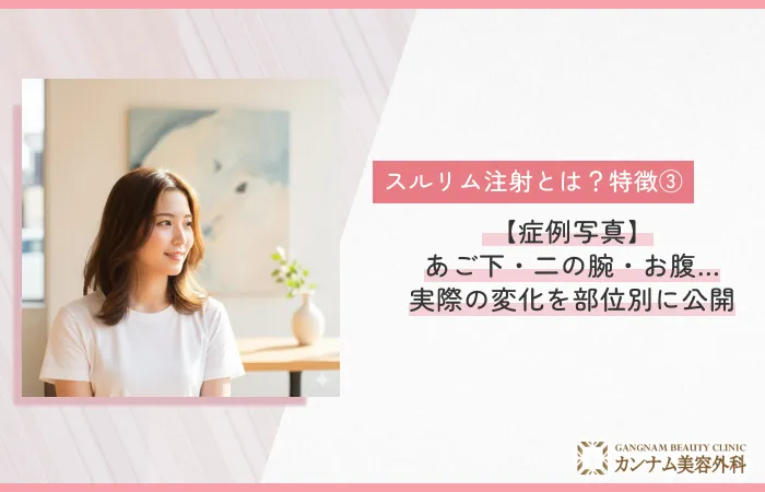 特徴③：【症例写真】あご下・二の腕・お腹…実際の変化を部位別に公開