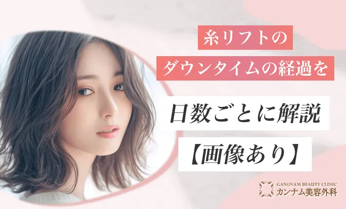 糸リフトのダウンタイムの経過を日数ごとに解説【画像あり】