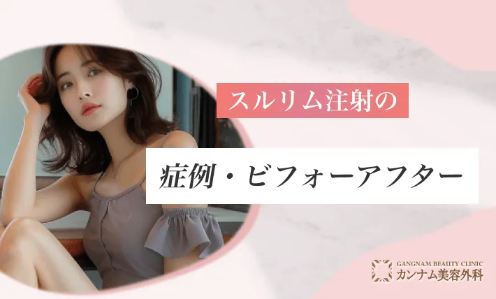 スルリム注射の症例・ビフォーアフター