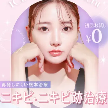 TCB東京中央美容外科のニキビ治療