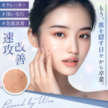 WIN CLINICのニキビ跡治療のイメージ
