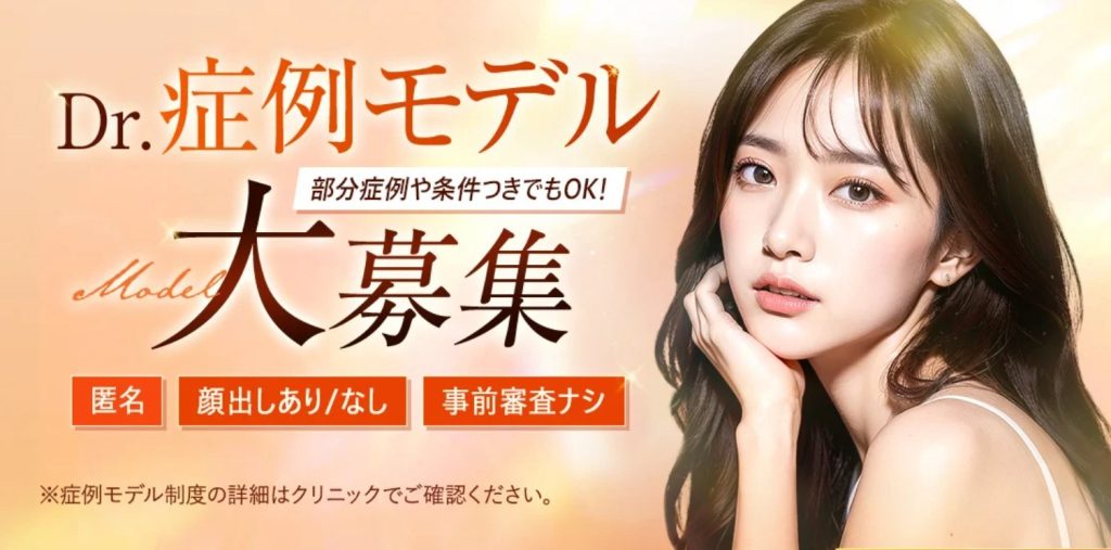 TCBの症例モデル大募集